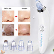 Derma suction - thesmartshope