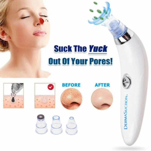 Derma suction - thesmartshope